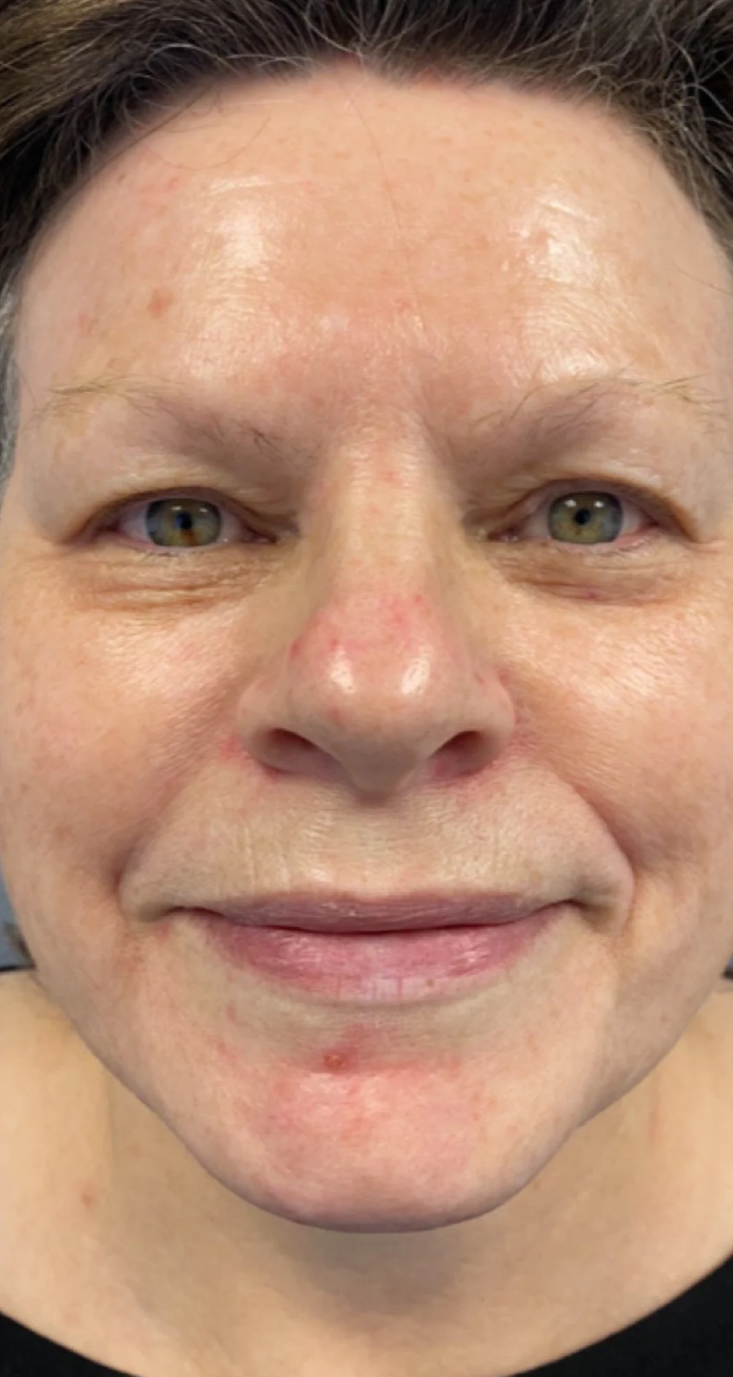 Before treatment 4