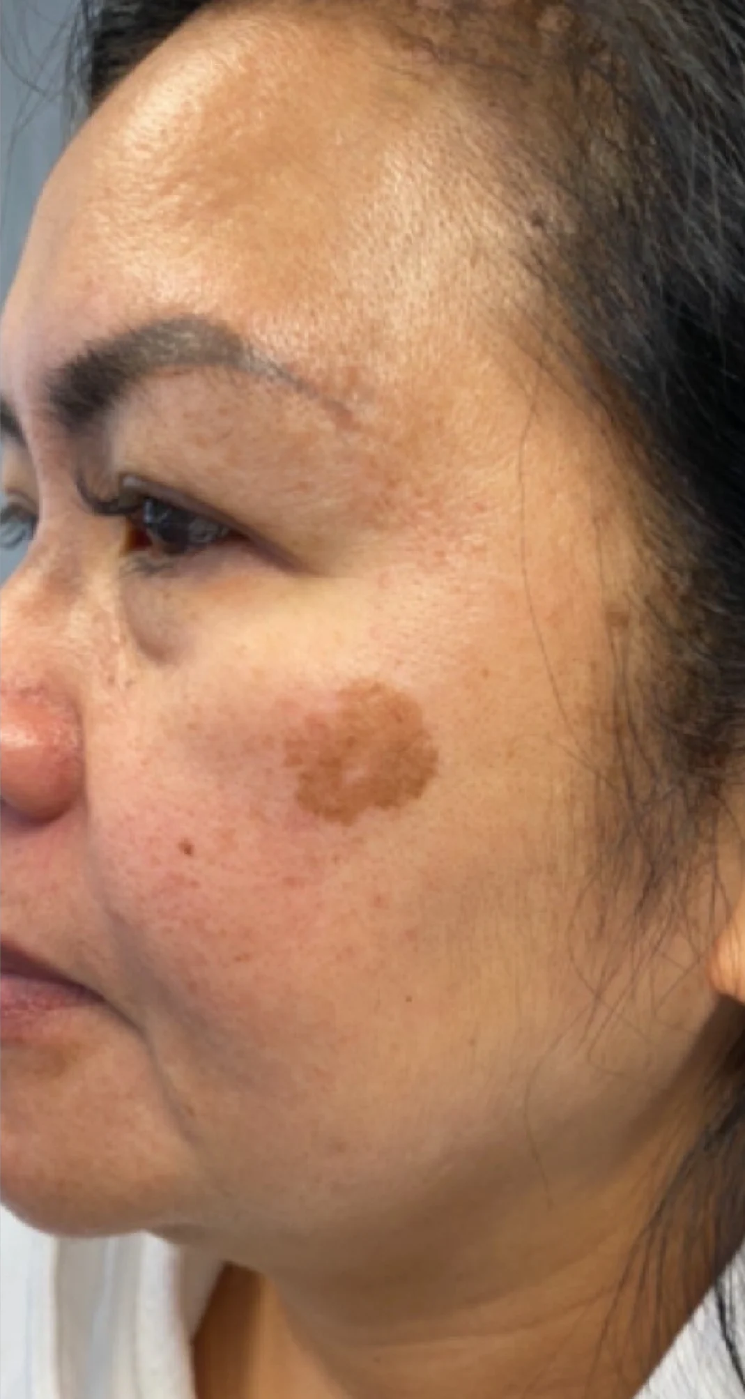 Before treatment 8