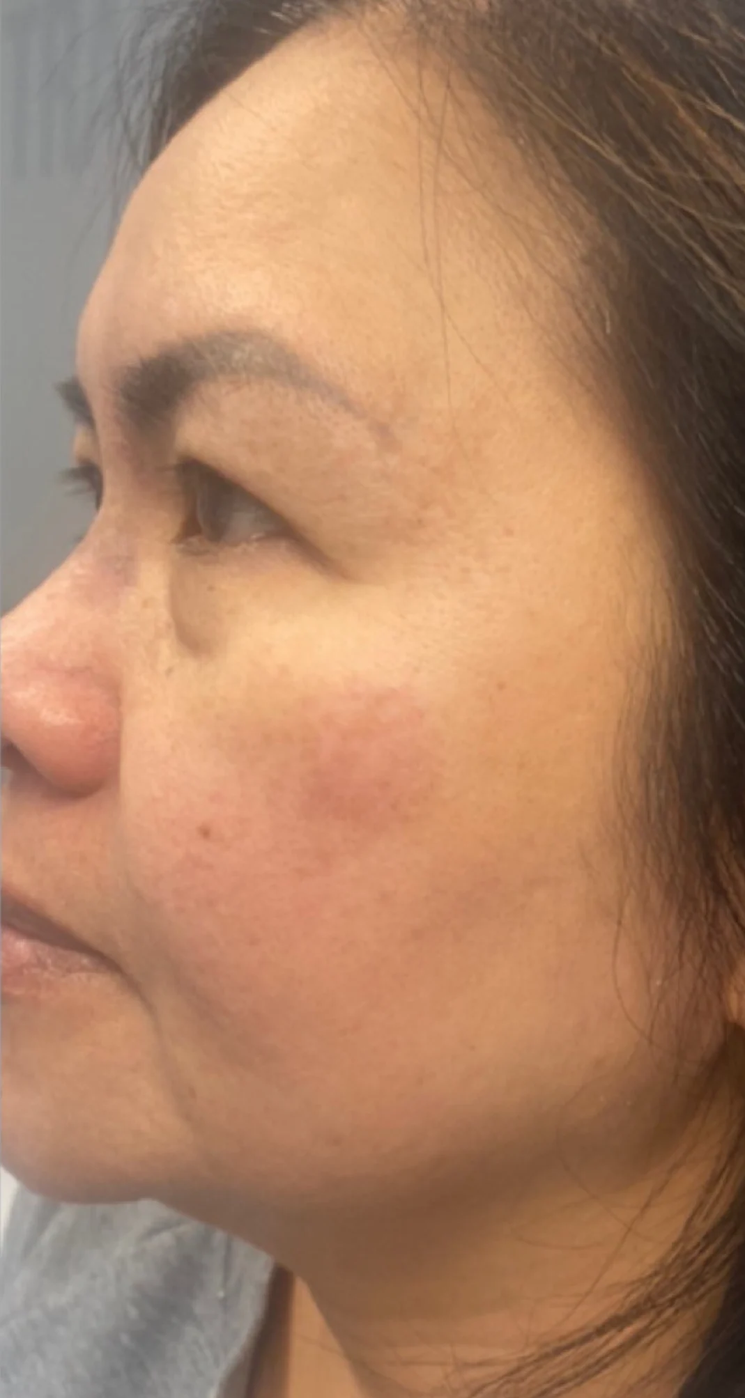 After treatment 8