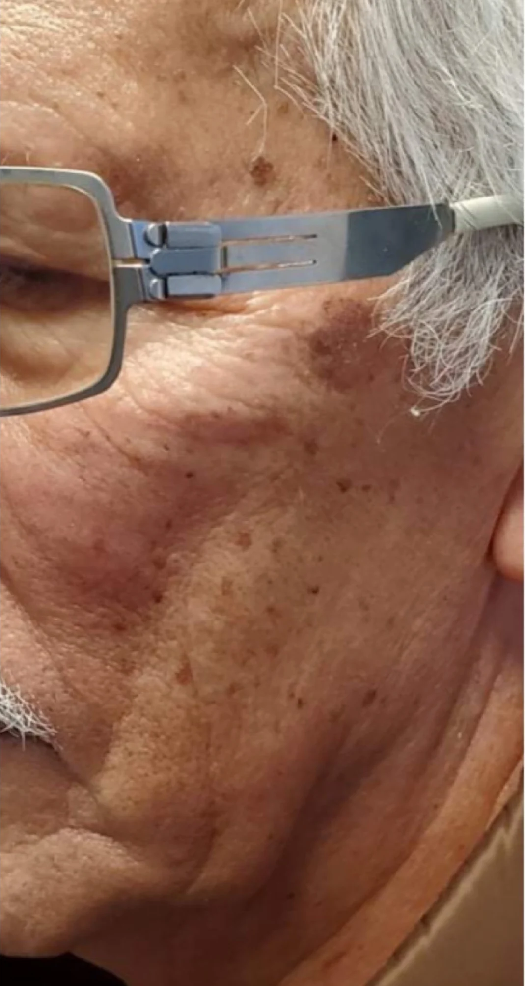 Before treatment 7