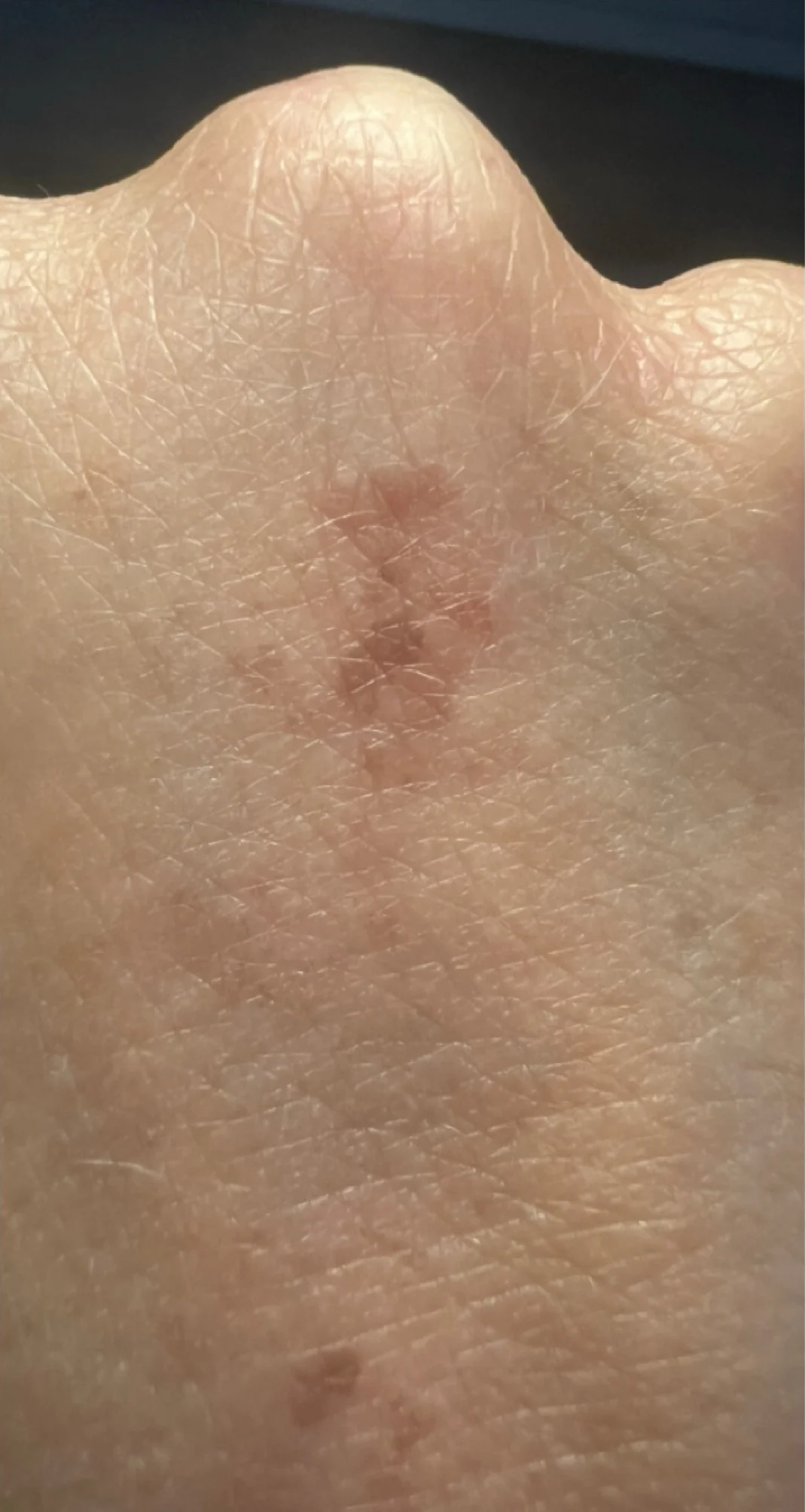 Before treatment 4