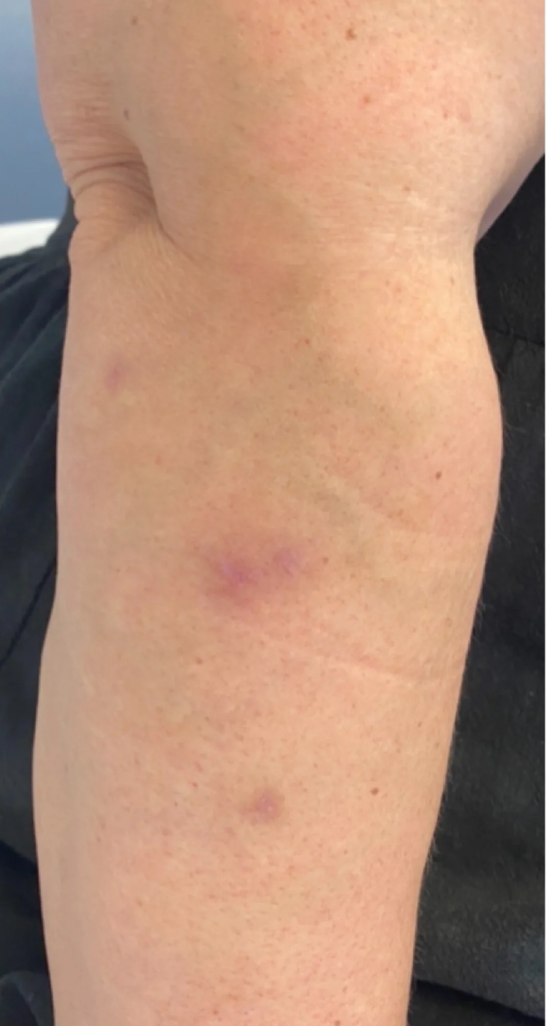 Before treatment 5
