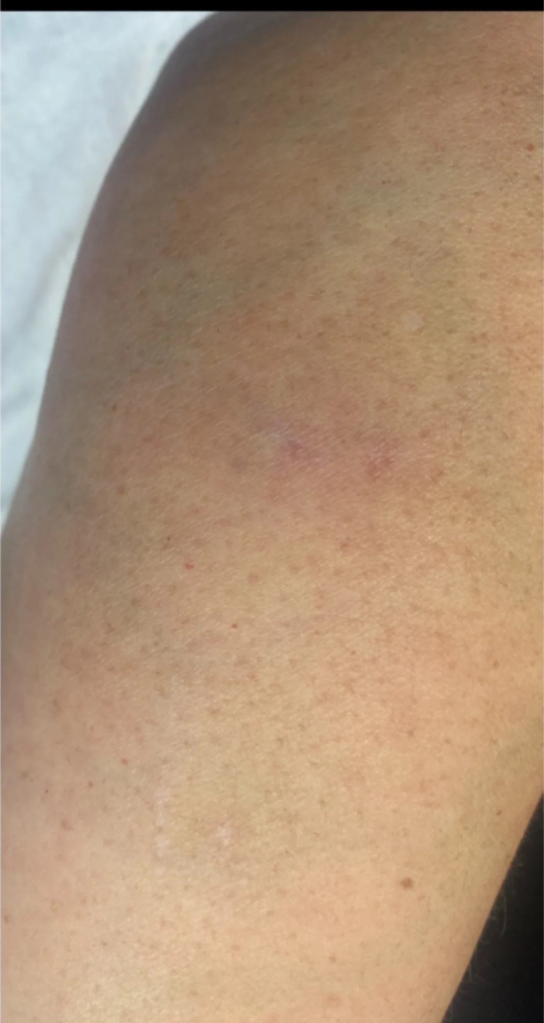 After treatment 5