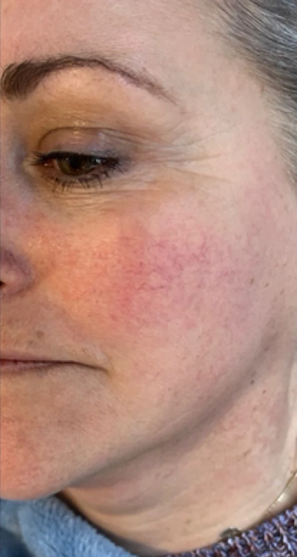 Before treatment 10