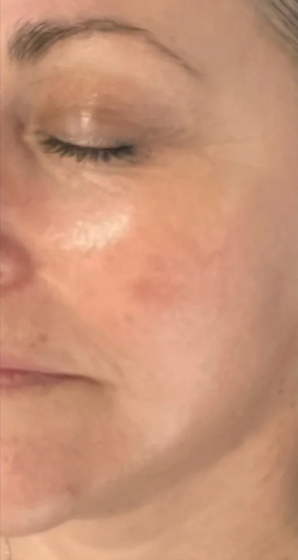 After treatment 10