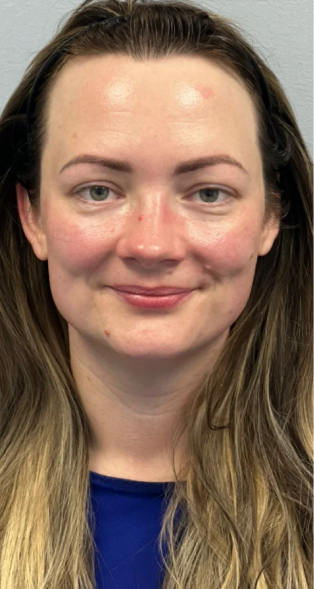 After treatment 5