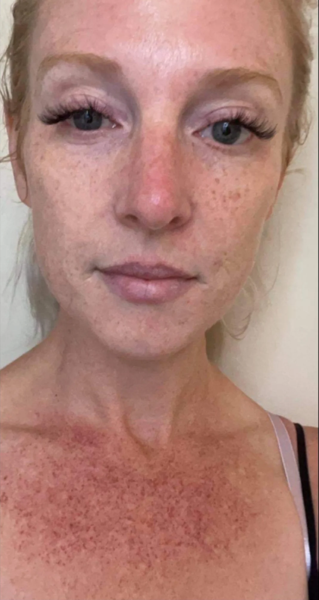 Before treatment 10