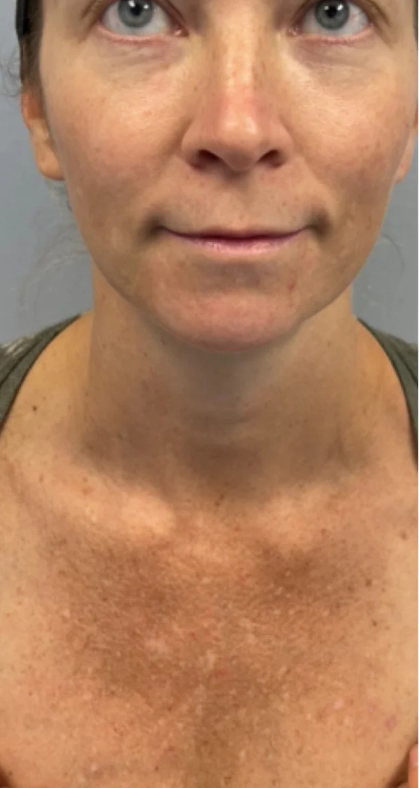 Before treatment 2