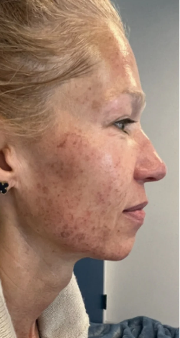 Before treatment 4
