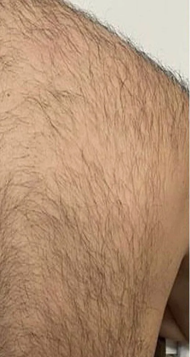 Before treatment 2