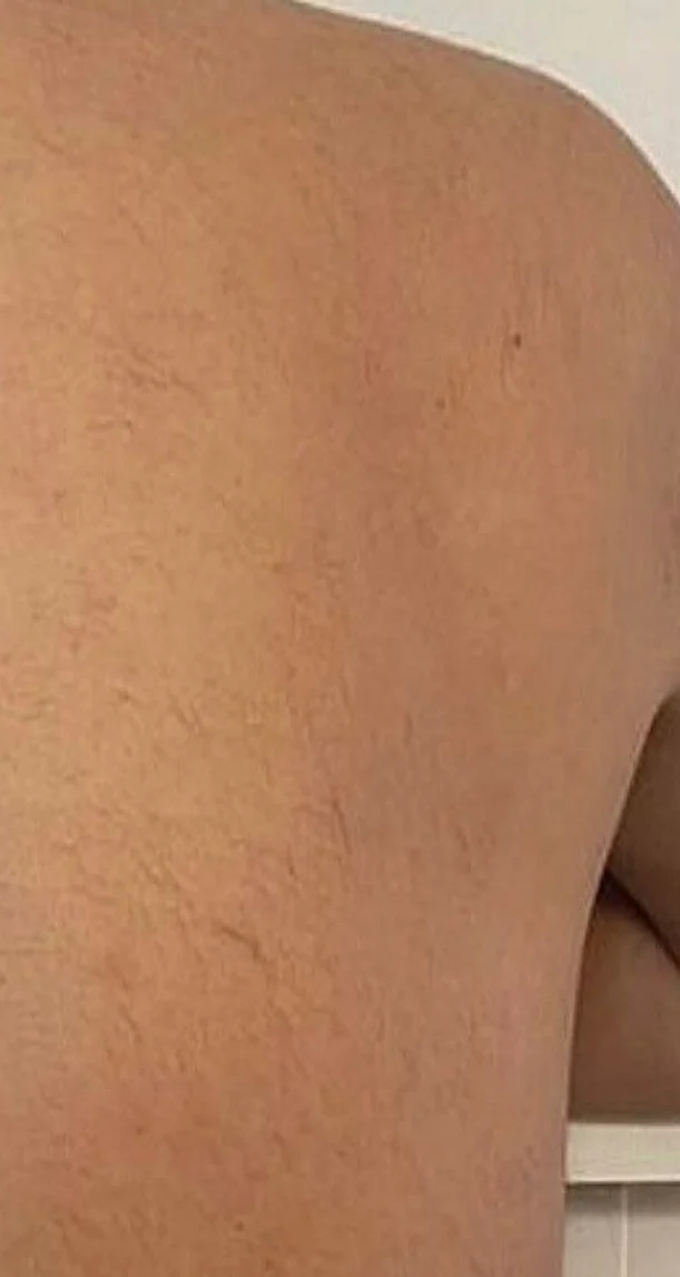 After treatment 2