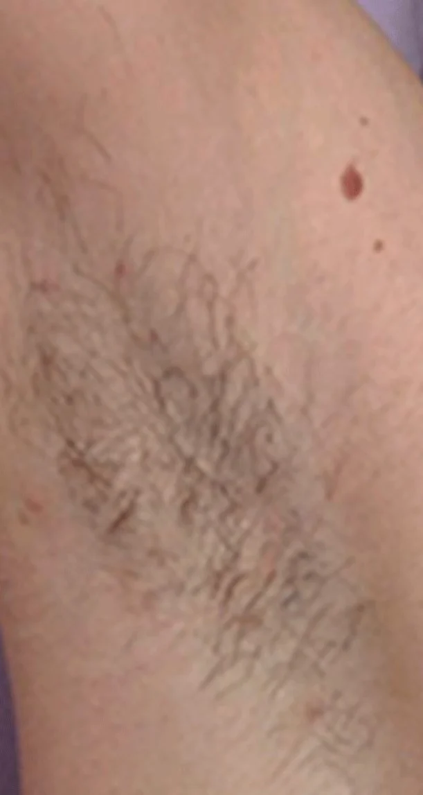 Before treatment 4