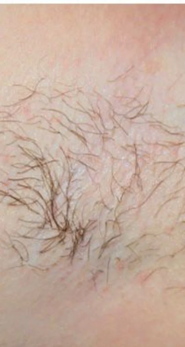 Before treatment 6