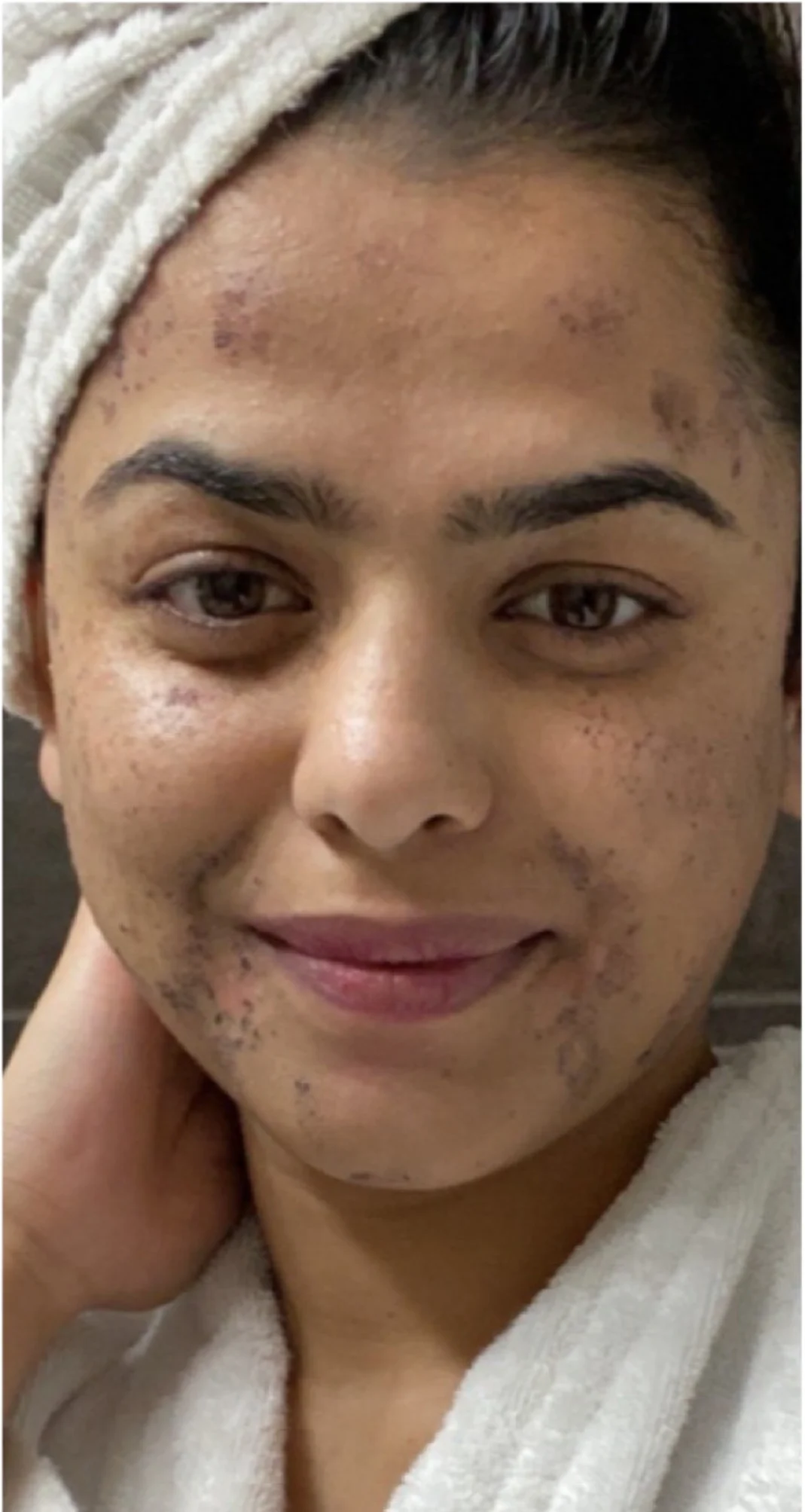 Before treatment 2