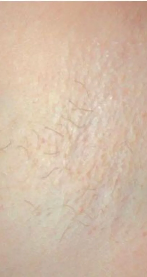 After treatment 6
