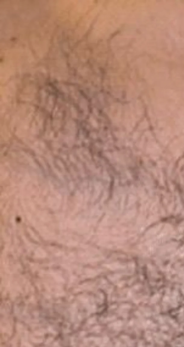 Before treatment 8