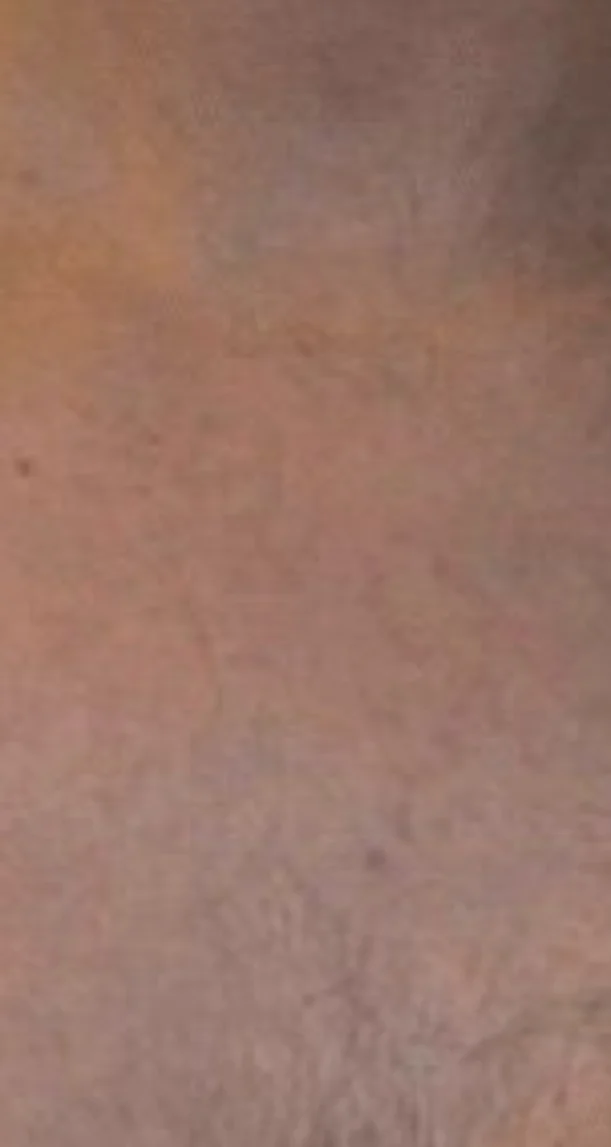 After treatment 8
