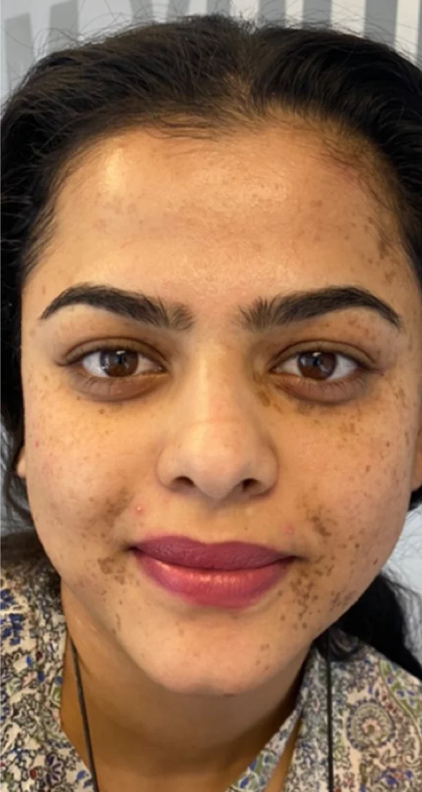 Before treatment 3