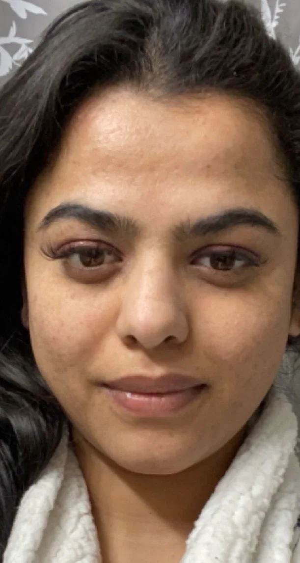 After treatment 7
