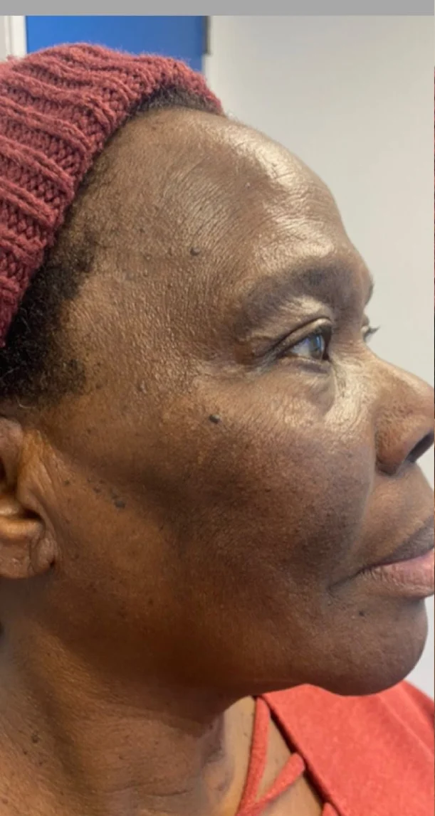 Before treatment 8