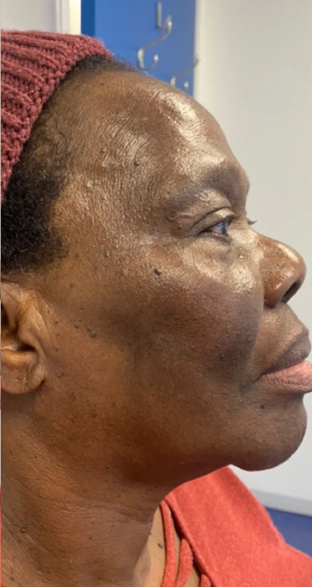 After treatment 8