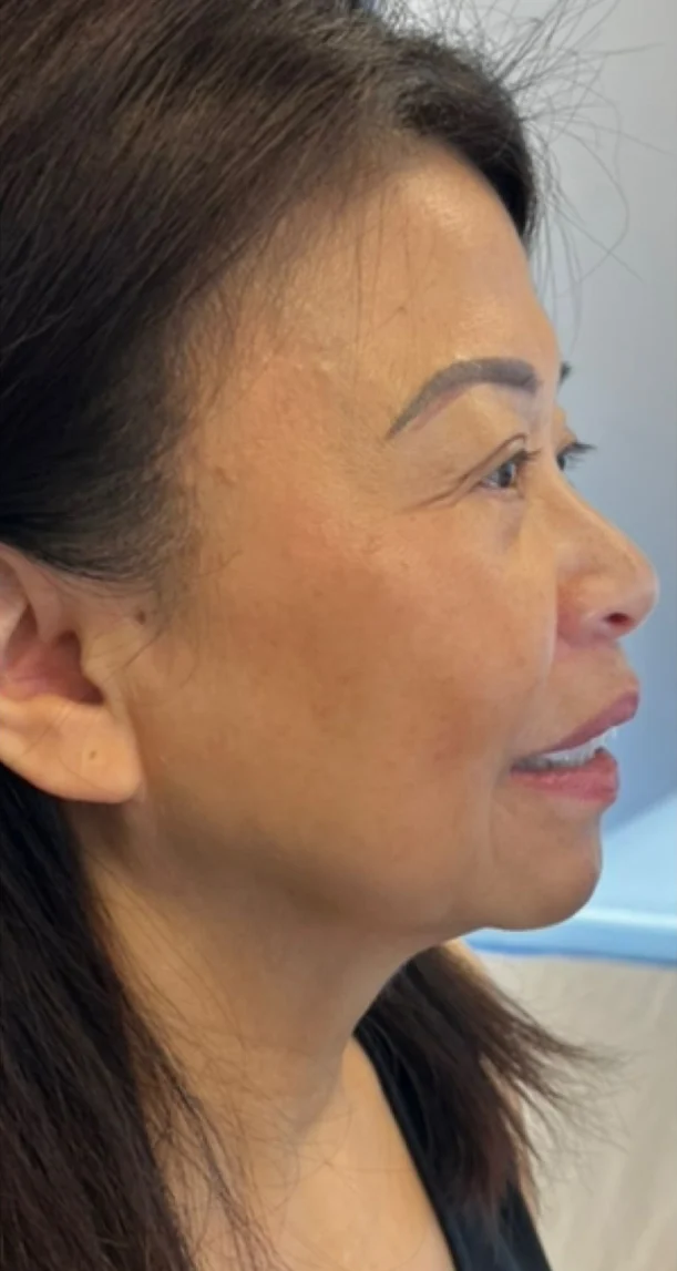 Before treatment 15