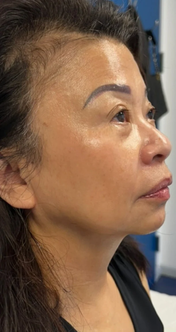 After treatment 15