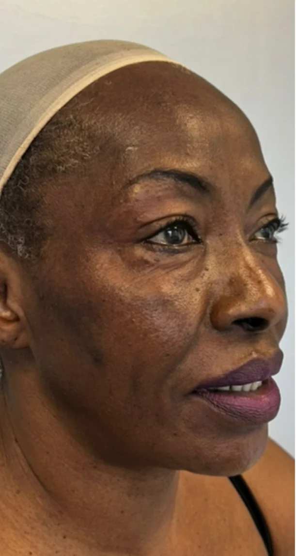 Before treatment 13