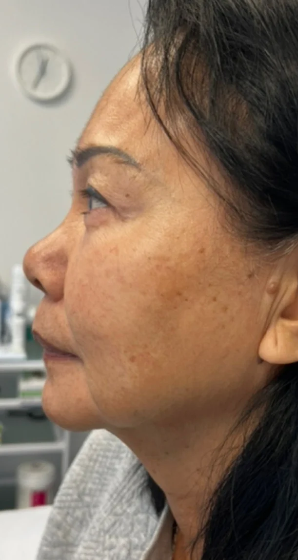 Before treatment 5