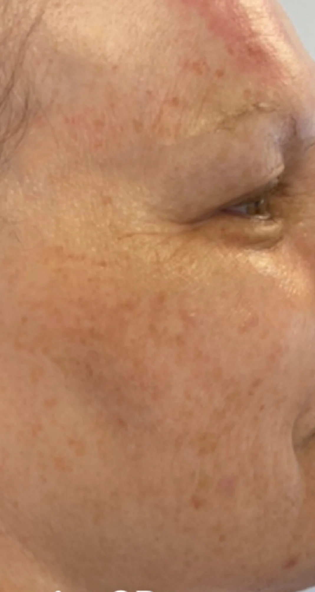 Before treatment 3