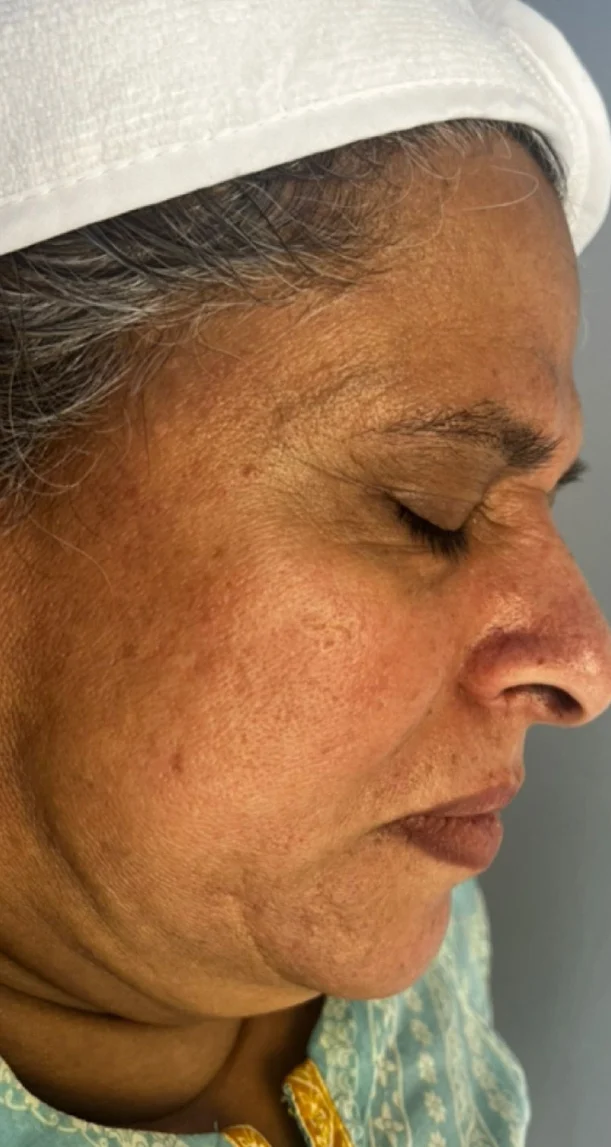 Before treatment 10