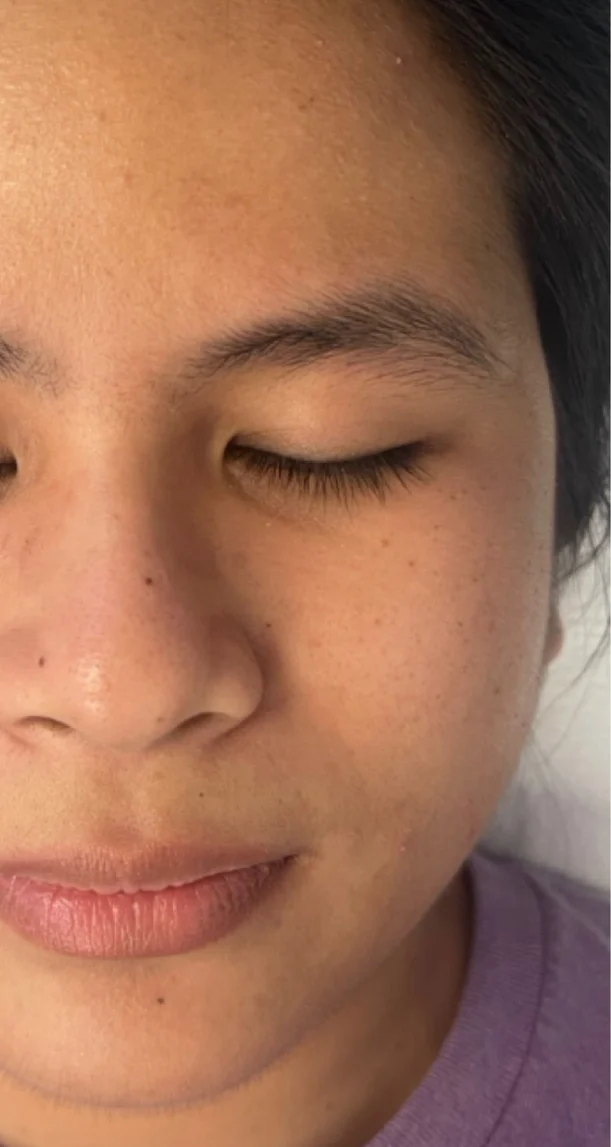 Before treatment 7