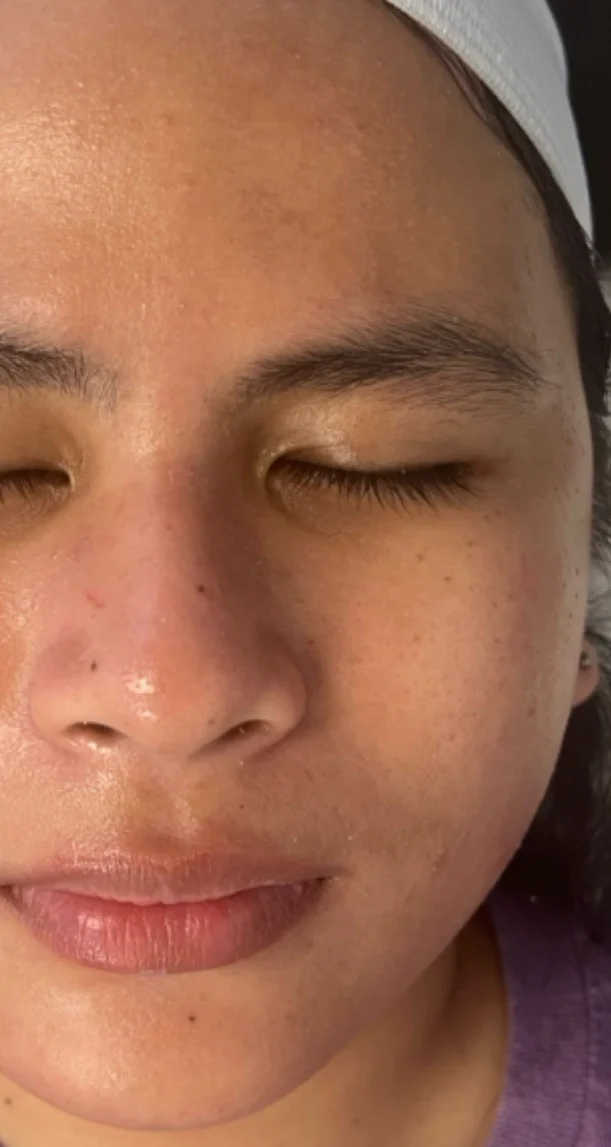 After treatment 7