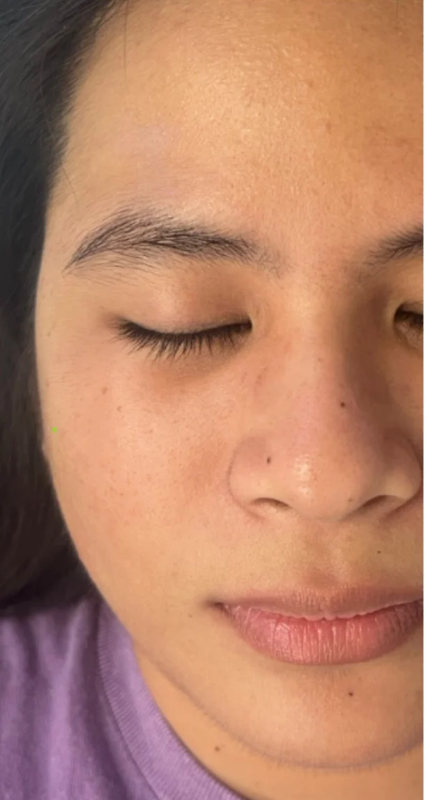 Before treatment 5