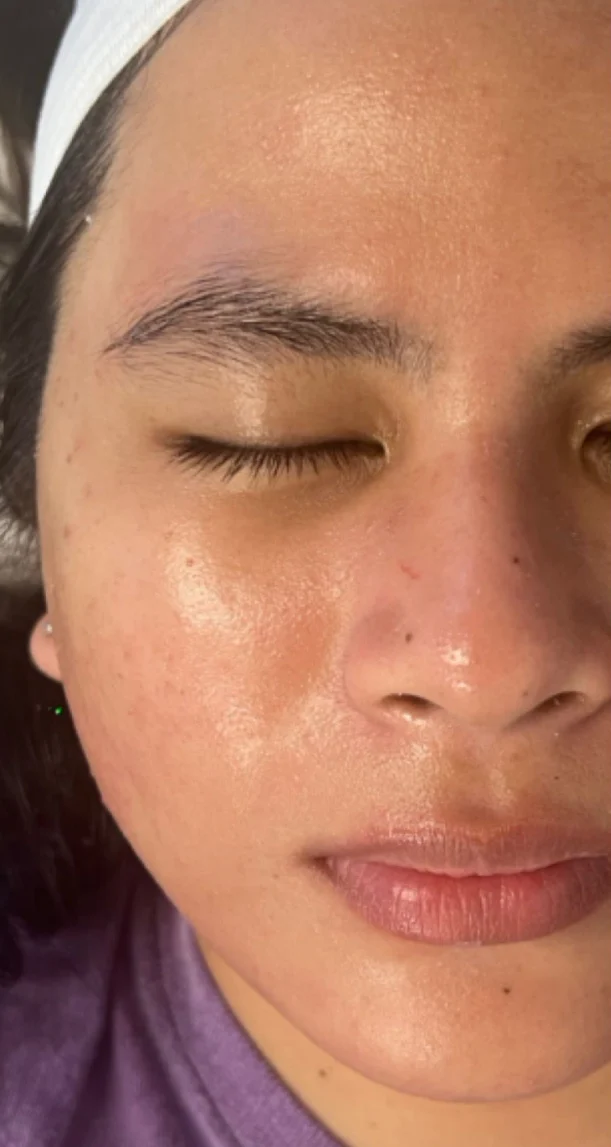After treatment 5
