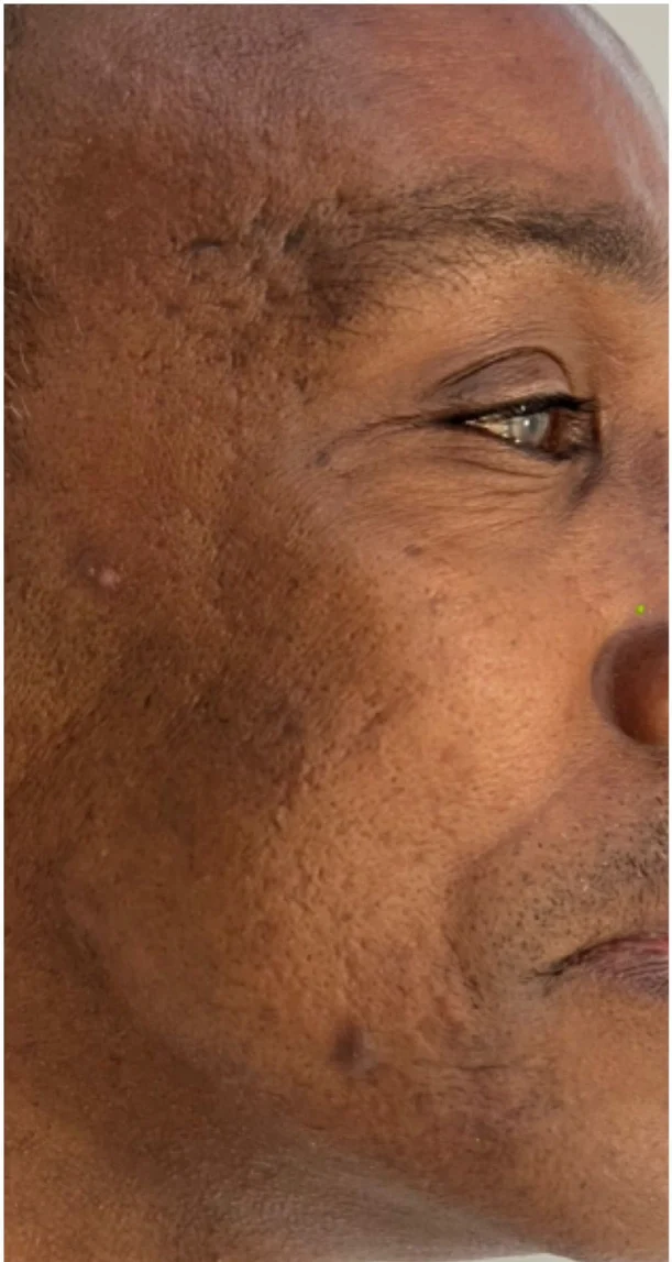 Before treatment 5