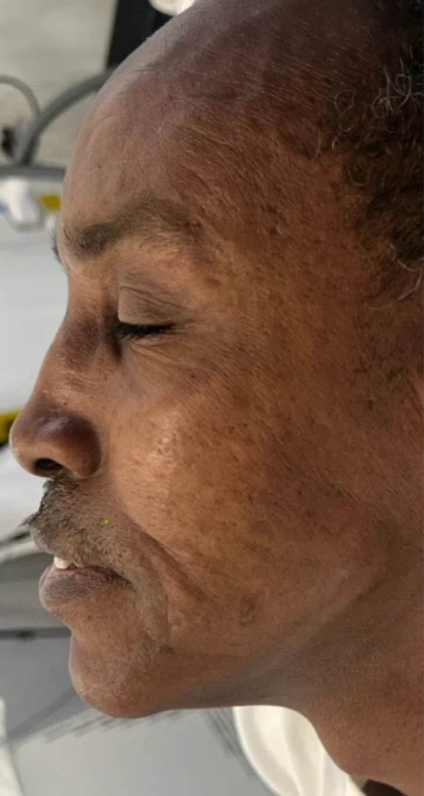 Before treatment 7